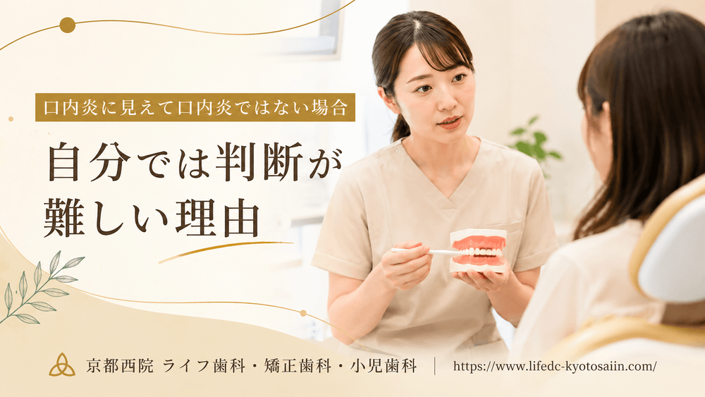 口内炎に見えて口内炎ではない場合|自分では判断が難しい理由