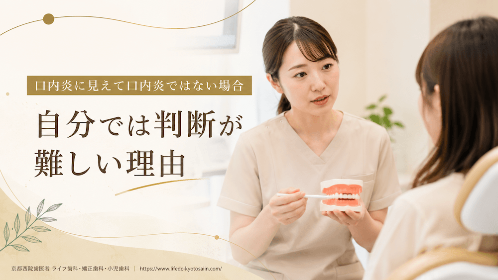 口内炎に見えて口内炎ではない場合｜自分では判断が難しい理由