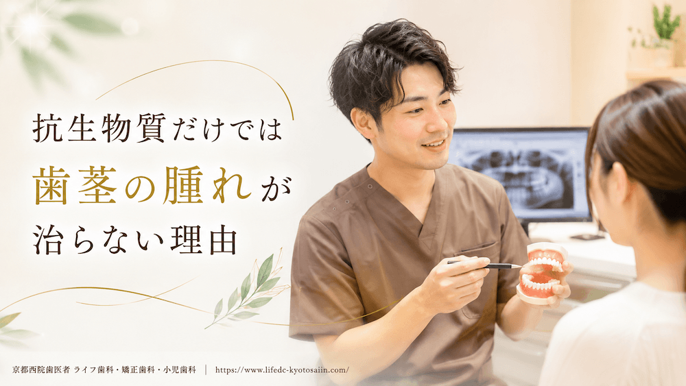 抗生物質だけでは歯茎の腫れが治らない理由